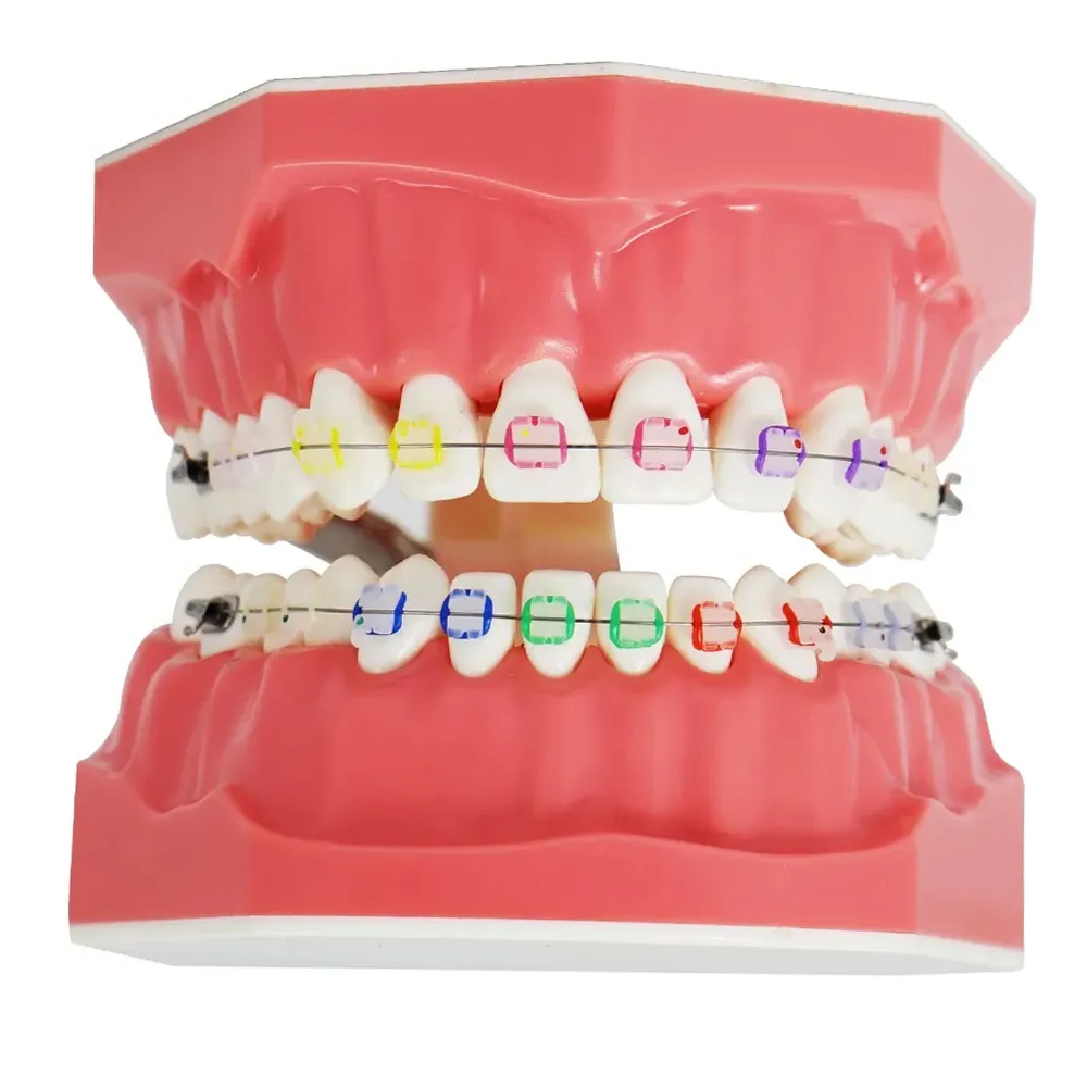 Identical Orthodontic Patient Education Model (Ceramic) M3002