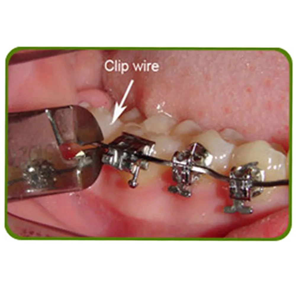 Buy Orthodontics Hard Wire Cuter 3000-7 GDC Online at Lowest